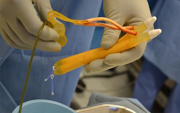 Implants in the penis